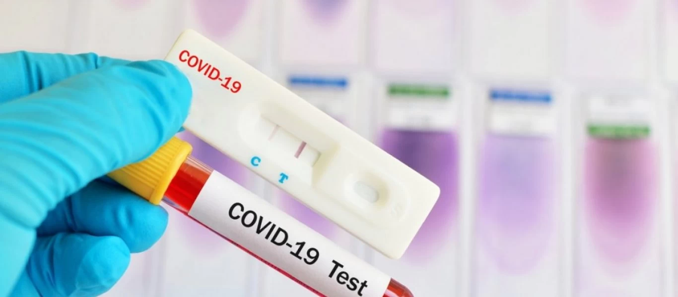 ΕΟΔΥ: Σε αυτές τις περιοχές γίνονται σήμερα δωρεάν rapid test